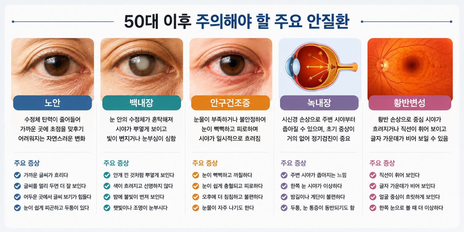 중장년 주요 안질환